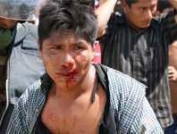 Peru: Amazon kan akıyor baksana*       